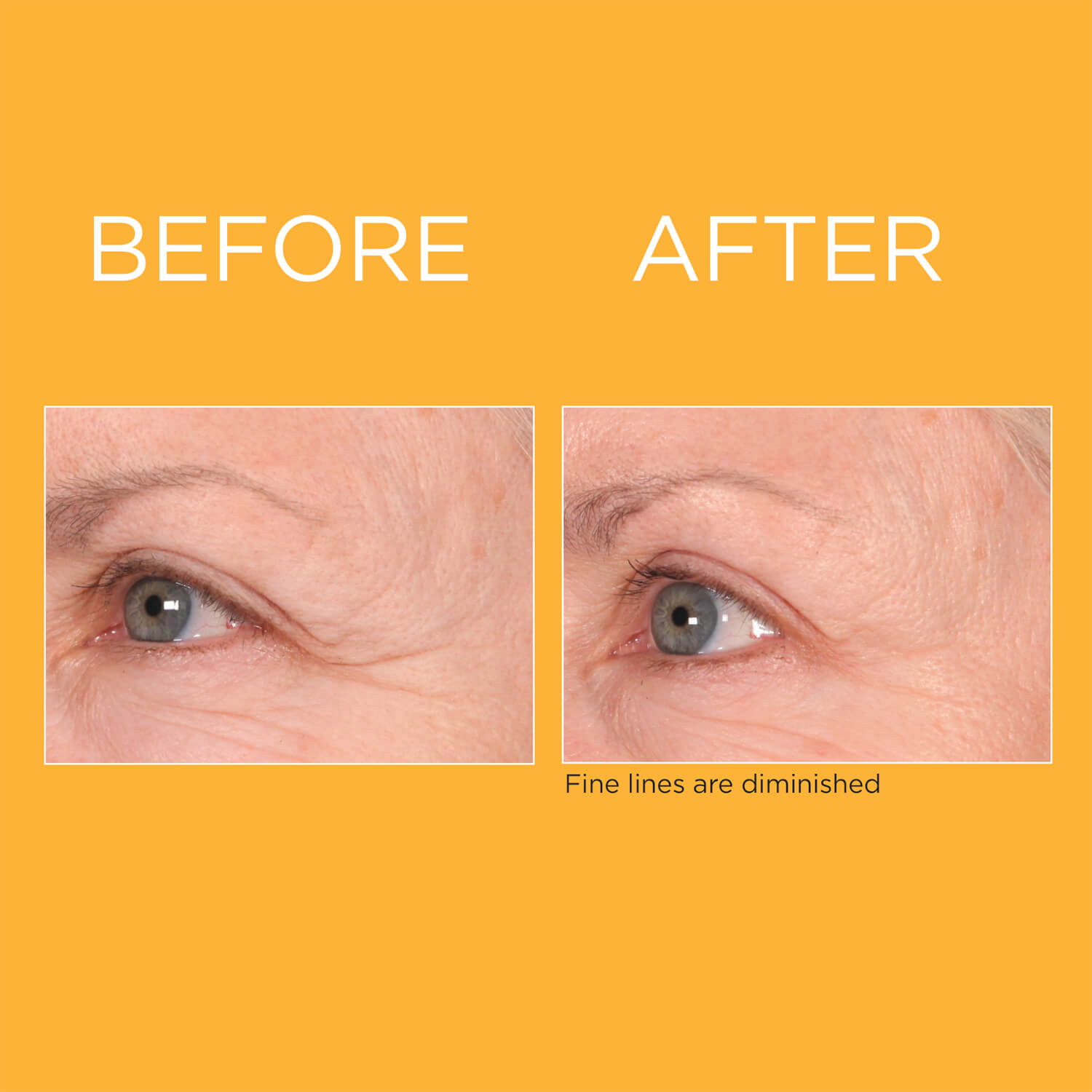 Elizabeth Arden Prevage® Progressive Renewal Treatment 4 Ampoules 5 Shaws Department Stores