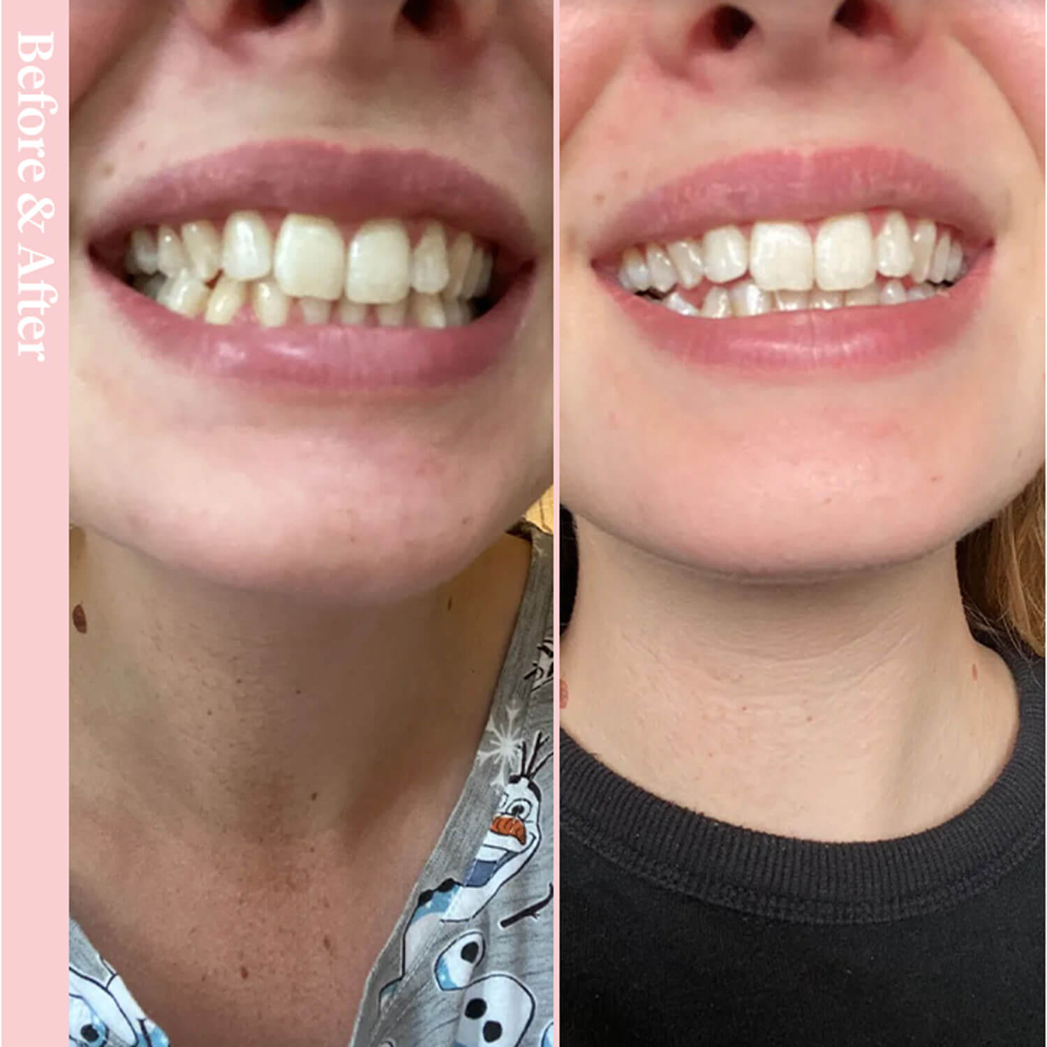 Spotlight Oral Care Toothpaste for Whitening Teeth 4 Shaws Department Stores