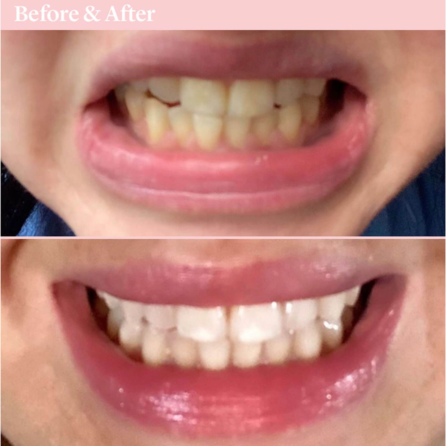 Spotlight Oral Care Toothpaste for Whitening Teeth 5 Shaws Department Stores