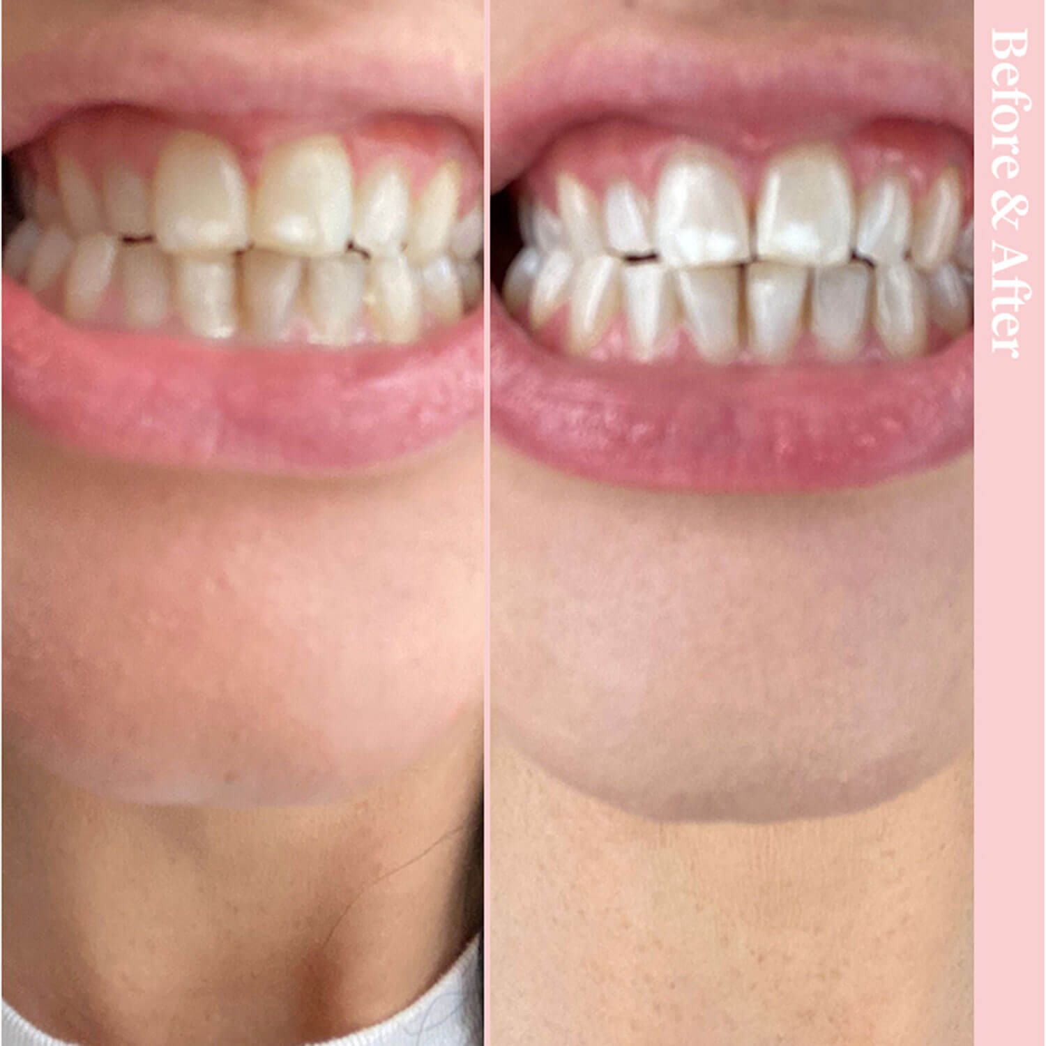 Spotlight Oral Care Toothpaste for Whitening Teeth 6 Shaws Department Stores