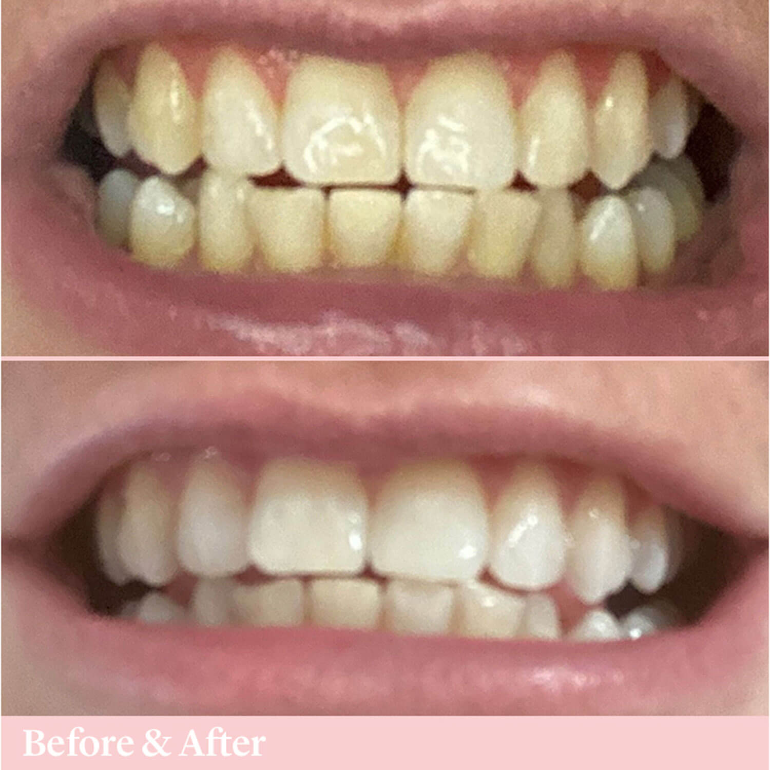 Spotlight Oral Care Toothpaste for Whitening Teeth 7 Shaws Department Stores