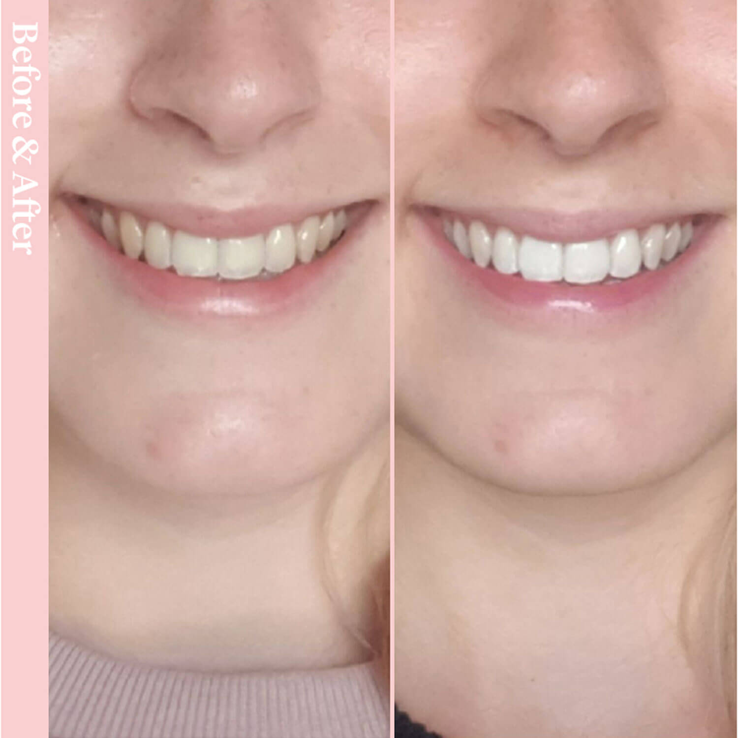 Spotlight Oral Care Toothpaste for Whitening Teeth 8 Shaws Department Stores