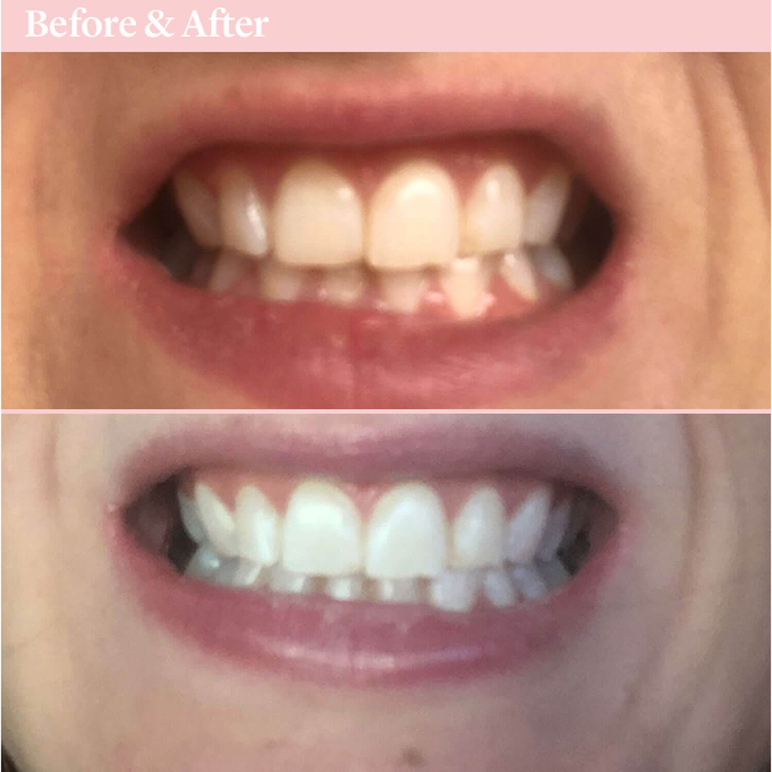 Spotlight Oral Care Toothpaste for Whitening Teeth 9 Shaws Department Stores