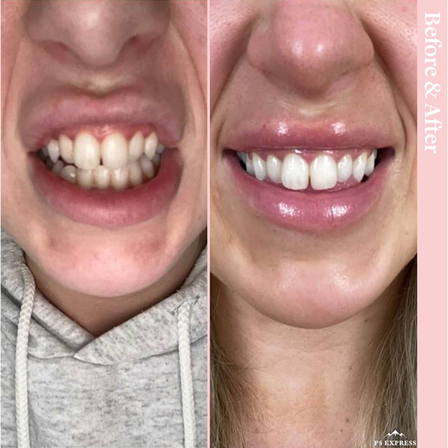 Spotlight Oral Care Toothpaste for Whitening Teeth 10 Shaws Department Stores