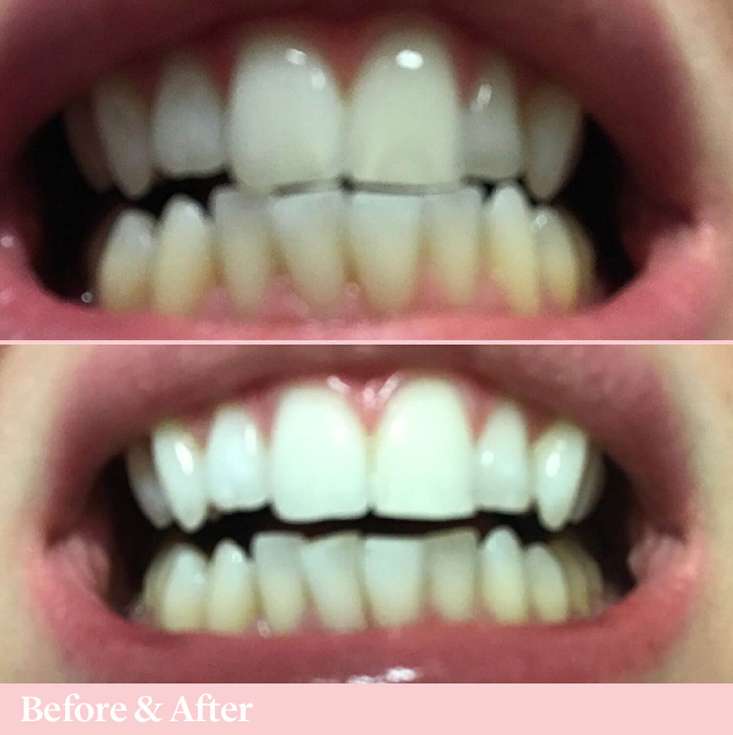 Spotlight Oral Care Toothpaste for Whitening Teeth 11 Shaws Department Stores