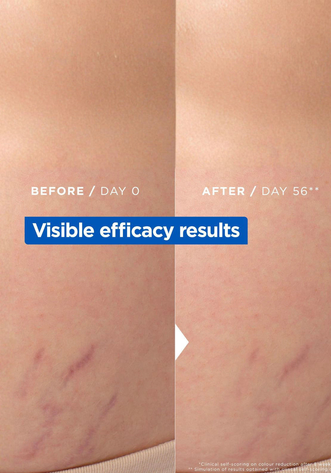 Mixa Stretch Mark Oil - Multi 2 Shaws Department Stores