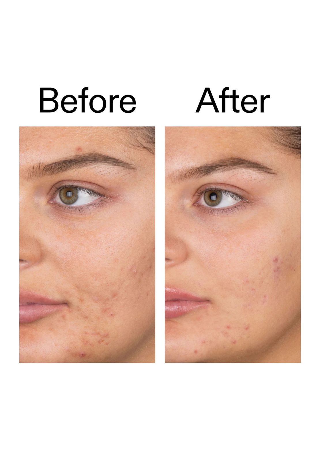 The Inkey List Salicylic Acid Cleanser 150ml 3 Shaws Department Stores