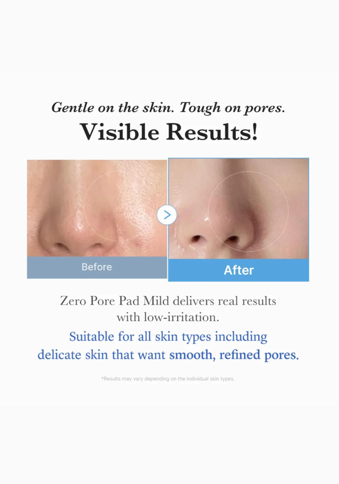 Zero Pore Pad Mild 70pc - No Colour